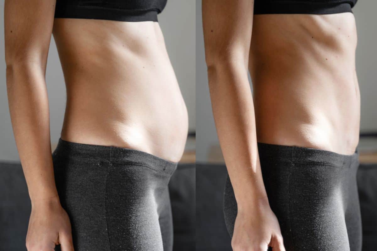 Post-Pregnancy: What Happens to Your Abdominal Muscles After Birth Greater London (Camden)