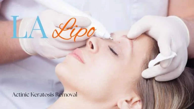 Woman receiving Actinic Keratosis Removal Treatment Greater London (Camden)