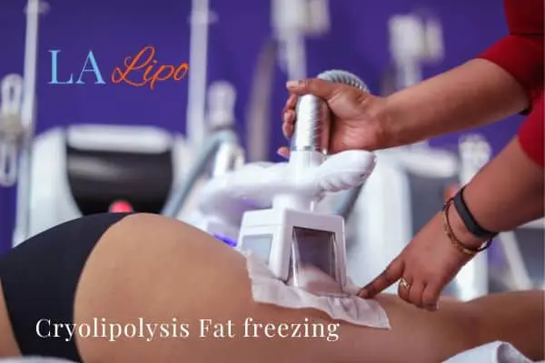 women getting fat freezing Greater London (Camden)