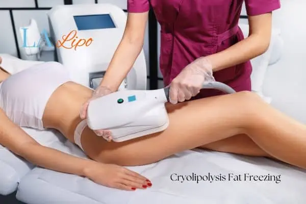 Woman receiving coolsculpting Greater London (Camden) treatment on her thighs