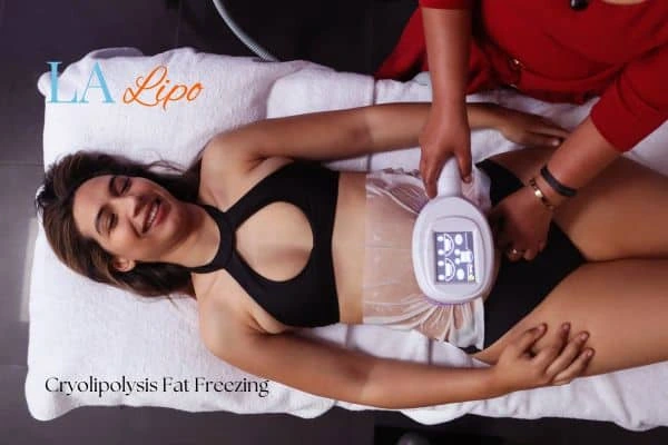 woman getting cryolipolysis Greater London (Camden)