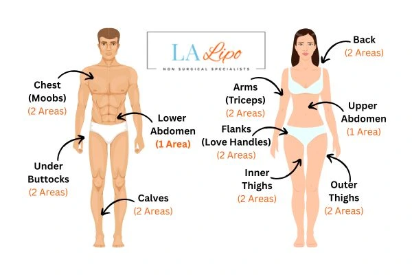 LA LIPO Cryolipolysis Areas Greater London (Camden)