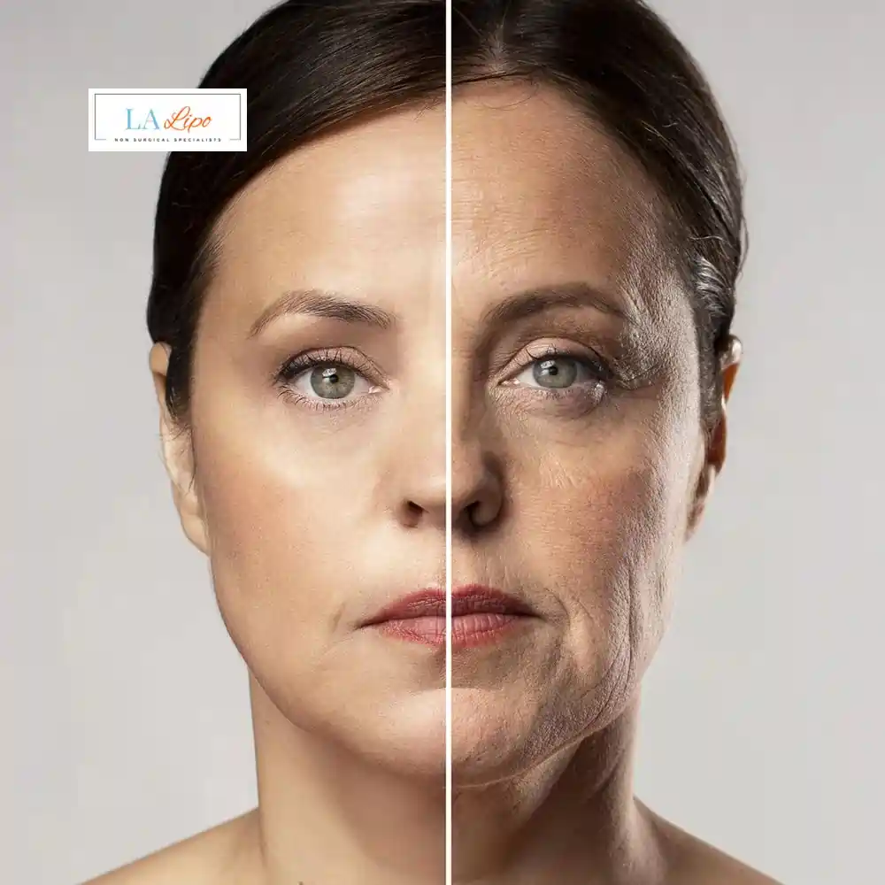 How Can You Tell If Non-Surgical Skin Tightening Is Right for You Greater London (Camden)?