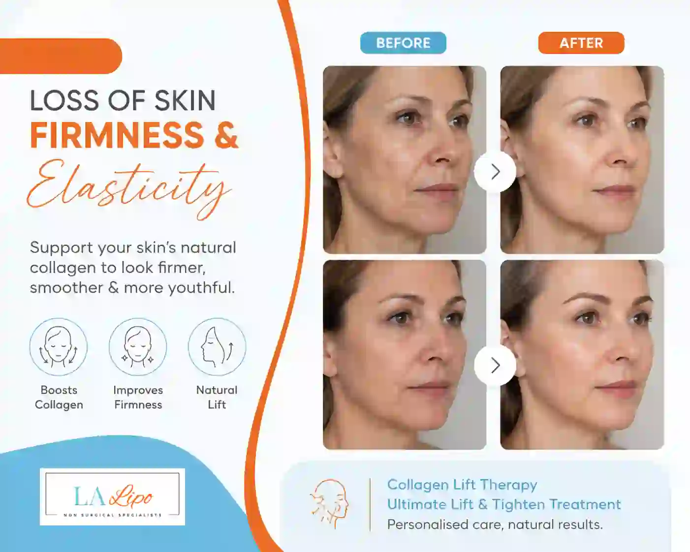 Sign #7: Loss of Skin Firmness and Elasticity Greater London (Camden)