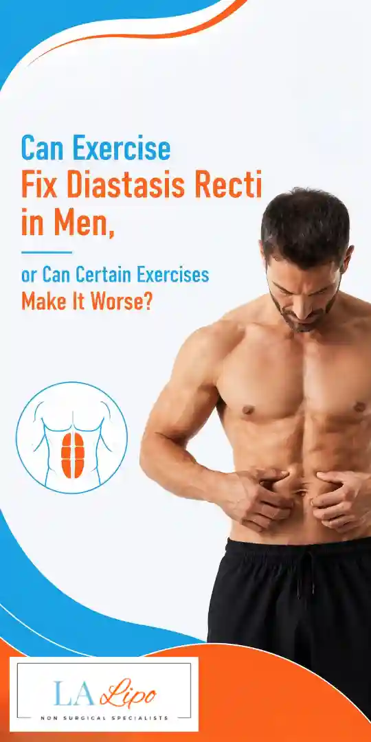 Can Exercise Fix Diastasis Recti in Men, or Can Certain Exercises Make It Worse Greater London (Camden)?